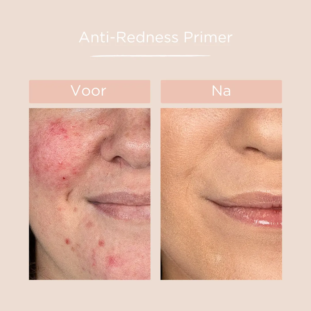 Anti-Redness Primer