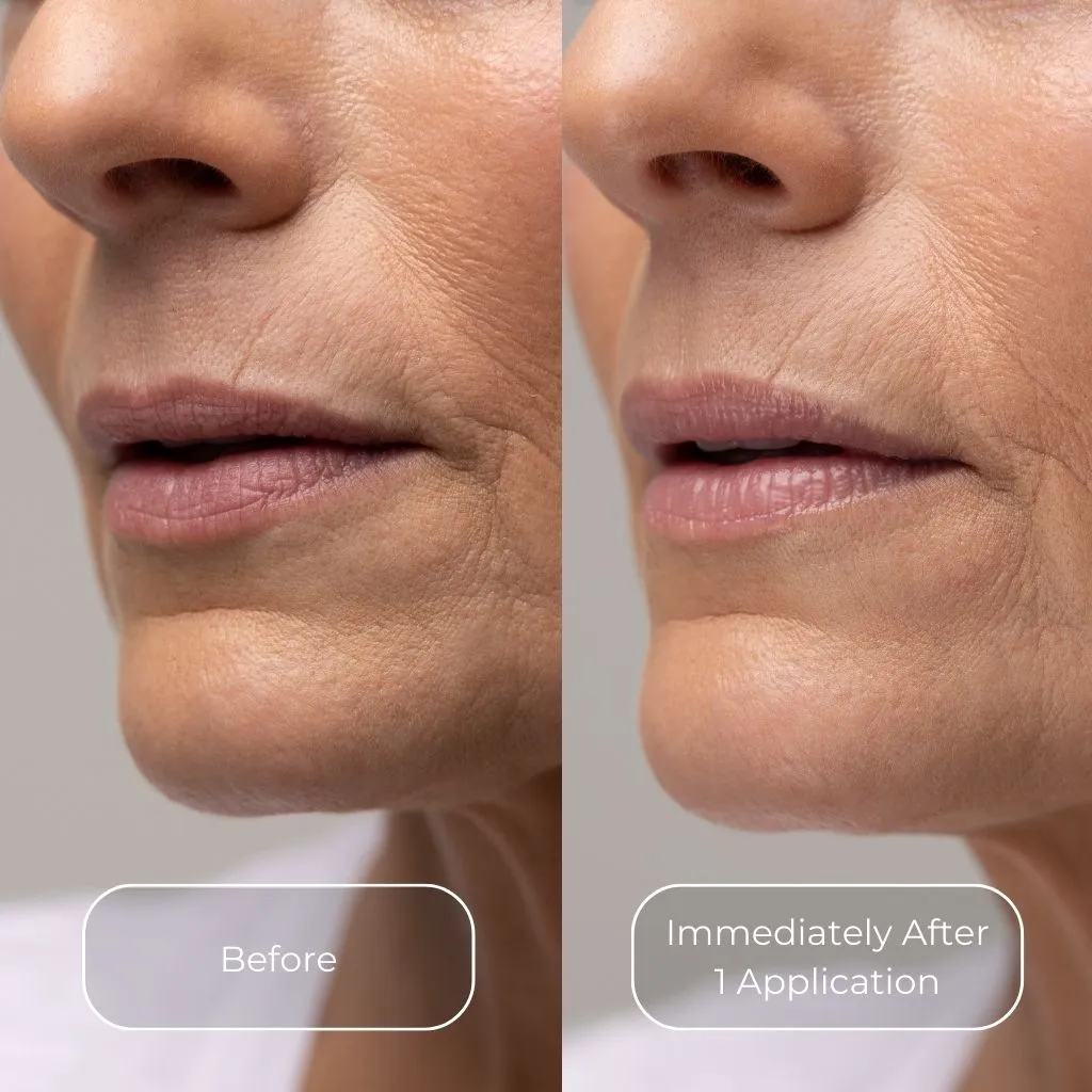 AO Lip Restore
