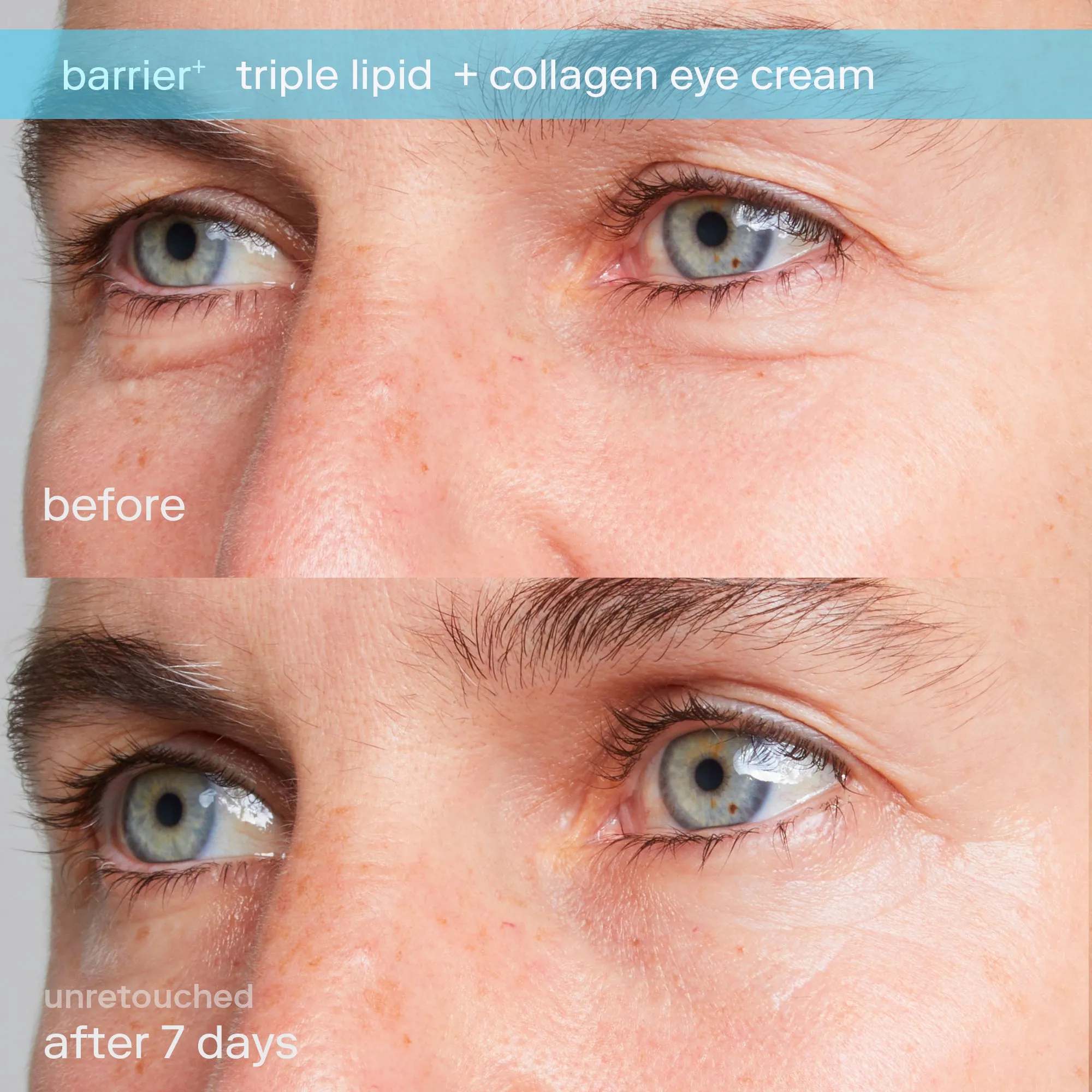 Barrier  Triple Lipid Boost Duo for Eyes & Lips