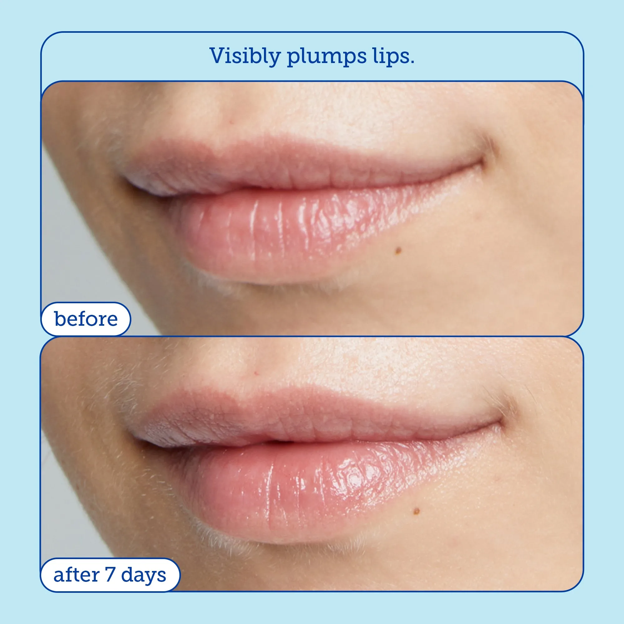 Barrier  Triple Lipid Boost Duo for Eyes & Lips