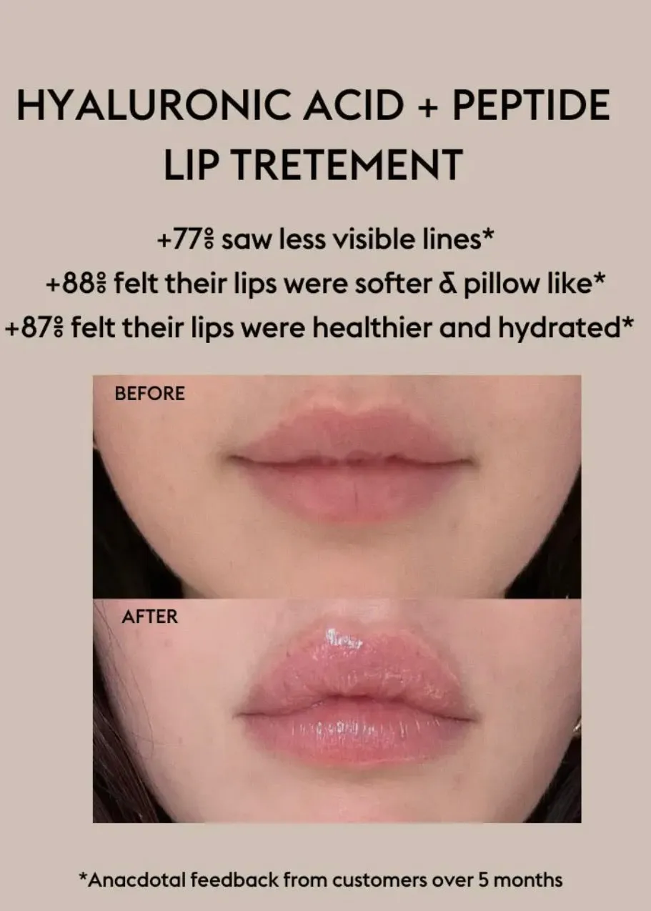 Hyaluronic Acid   Peptide Lip Treatment